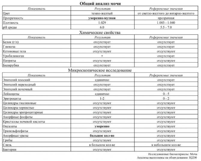 Анализ мочи на кетоновые тела | детские анализы в медицинской лаборатории эндомедлаб  (г. москва, м. дмитровское, м. борисово)