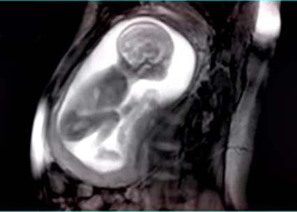 Можно ли делать мрт беременным  безопасна ли томография на ранних стадиях беременности