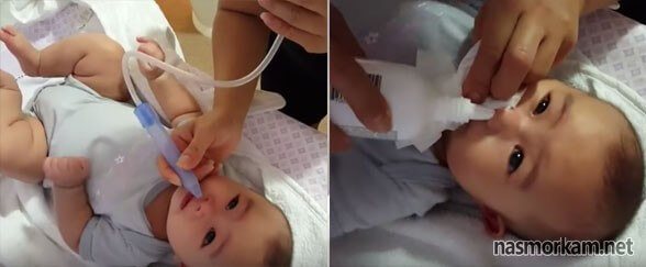 Физраствор для промывания носа новорожденному: можно ли грудничку, механизм действия и побочные эффекты