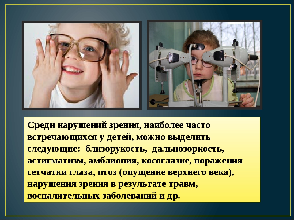 Снижение зрения у подростков: причины, симптомы, лечение