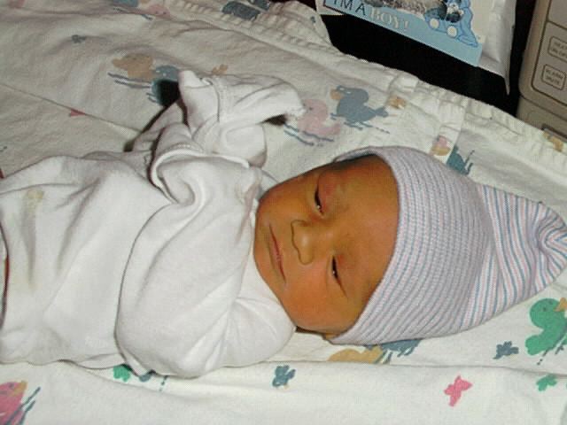 Желтушка у младенцев фото
