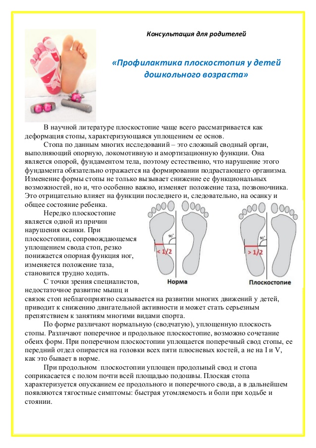 Плоская стопа: можно ли исправить плоскостопие у ребёнка? | здоровье | аиф красноярск
