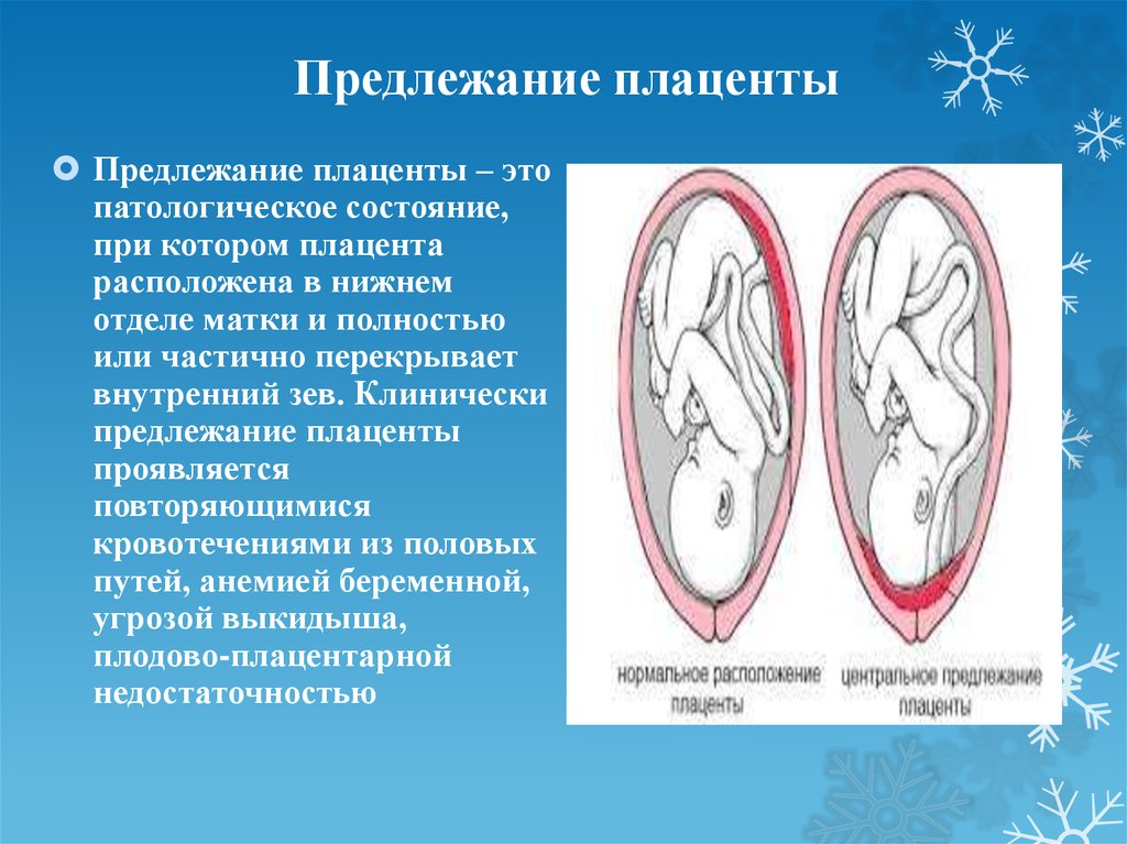 Типы плацент презентация