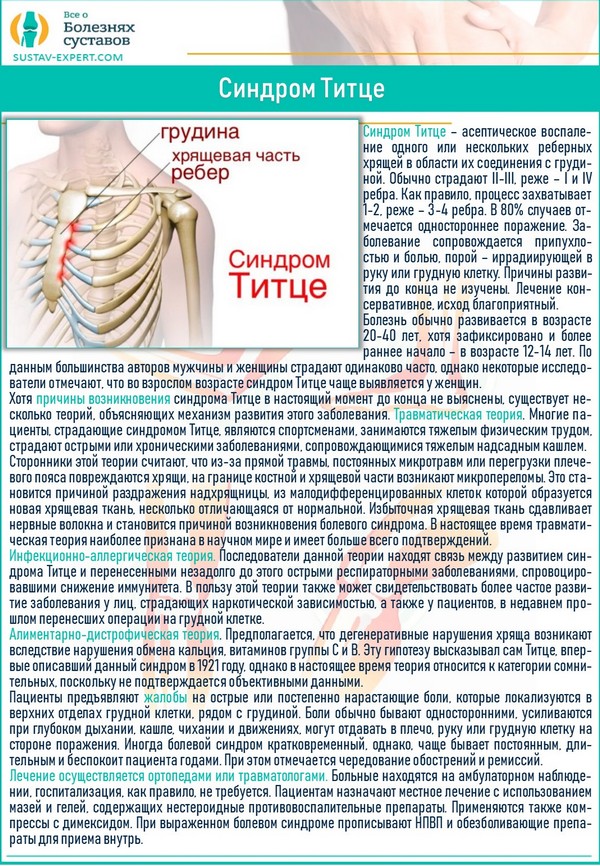 Мастит, его причины, симптомы и лечение