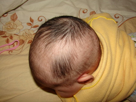 Почему у грудного ребенка плохо растут волосы на голове