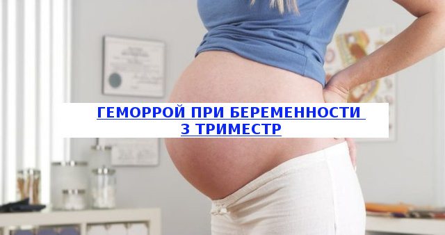 Геморрой при беременности - что делать, как и чем лечить