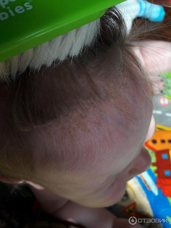 Корочка на голове у ребенка | pampers ru