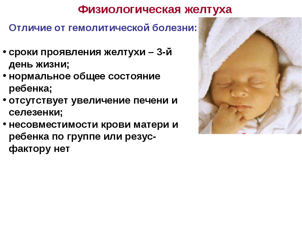 Ребенок желтуха почему. Физиологическая желтуха новорожденных характеризуется. Гемолитическая болезнь новорожденных и физиологическая желтуха. Критерии физиологической и патологической желтухи у новорожденных. Срок появление физиологической желтухи у новорожденных.
