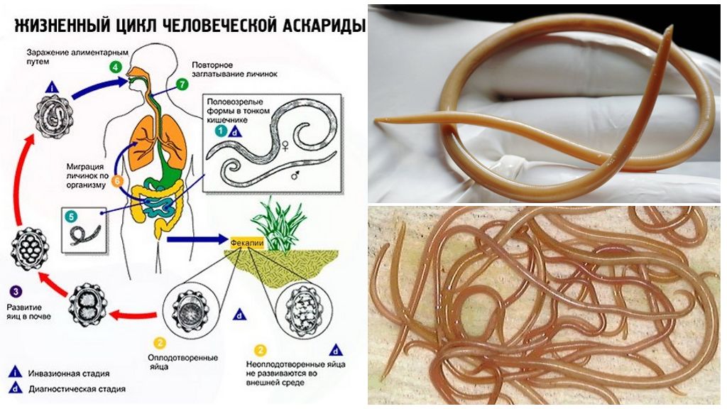 Аскарида человеческая – симптомы и лечение / паразит03: чистим организм правильно | beauty-line14a.ru