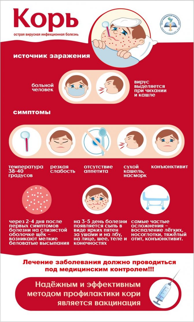 Корь-симптомы у детей, лечение, профилактика и первые признаки кори