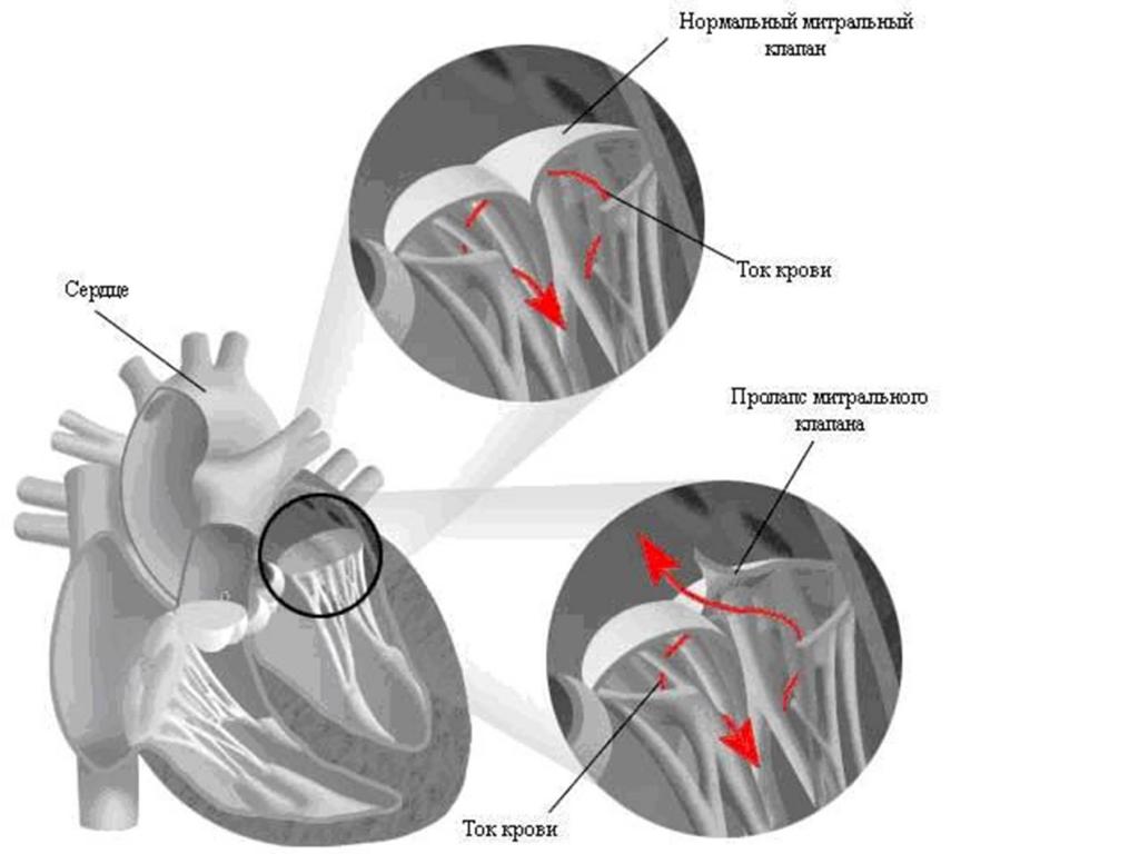 Врожденные пороки сердца: виды и методы диагностики