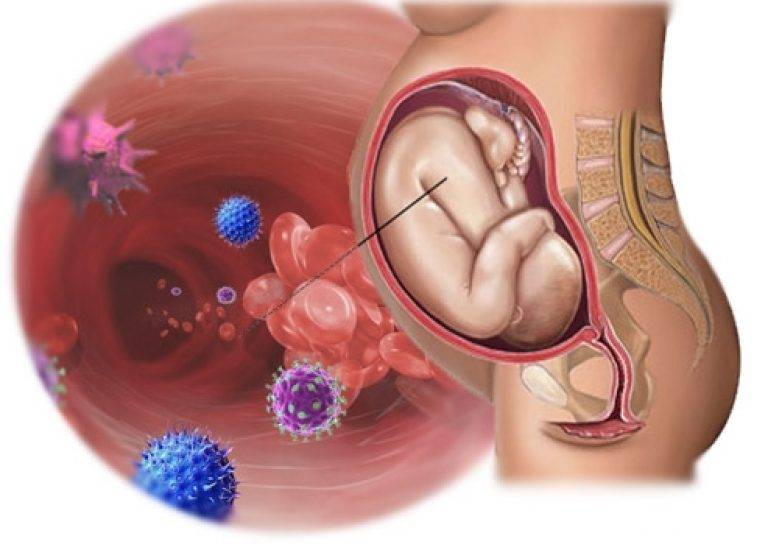 Атрофический вагинит — болезнь женщин “за 50», которая лечится интимом * клиника диана в санкт-петербурге