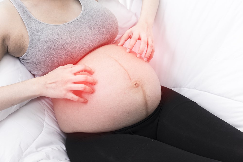 Почему чешется живот во время беременности? что делать если чешется живот во время беременности