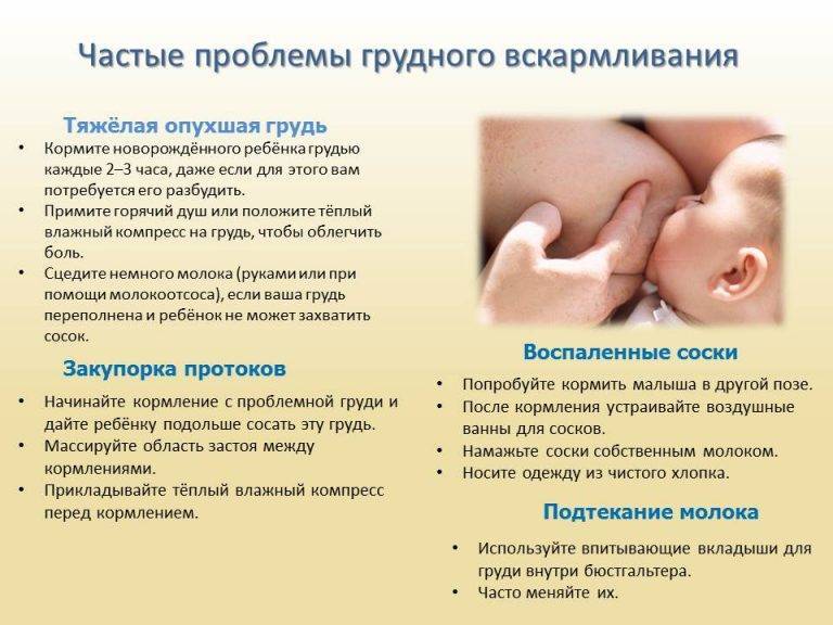 Лактостаз