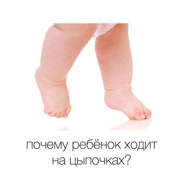 Как отучить ребенка ходить на носочках