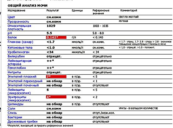 Повышены эритроциты в моче у женщины. Лейкоциты в моче мкл норма. Уровень лейкоцитов в 1 мл мочи в норме. Лейкоциты в моче полуколичественно норма. Норма лейкоцитов в моче в 1 мкл.