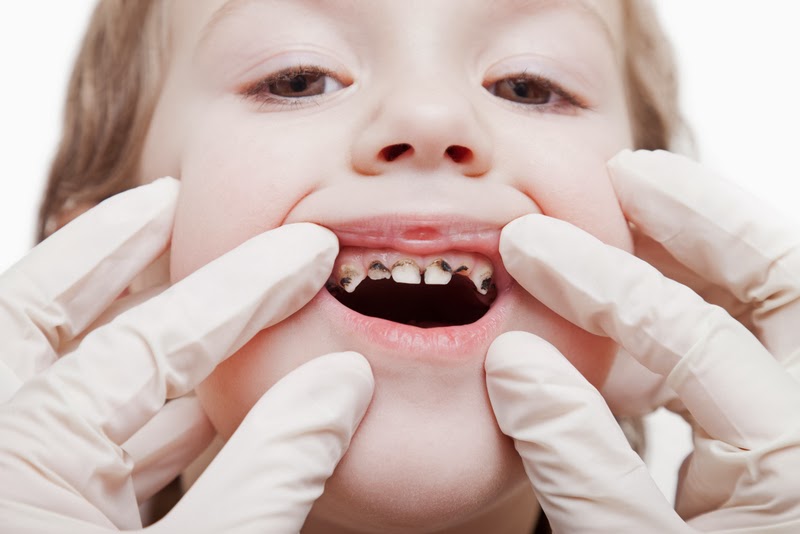 Они идут! все, что нужно знать родителям о прорезывании зубов у детей - здоровые люди