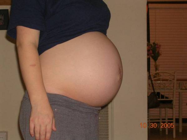Ведение беременности: рекомендации врача-гинеколога