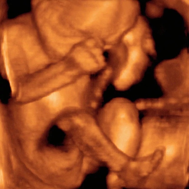 35 неделя беременности: что происходит с малышом и мамой. пора готовиться в роддом.