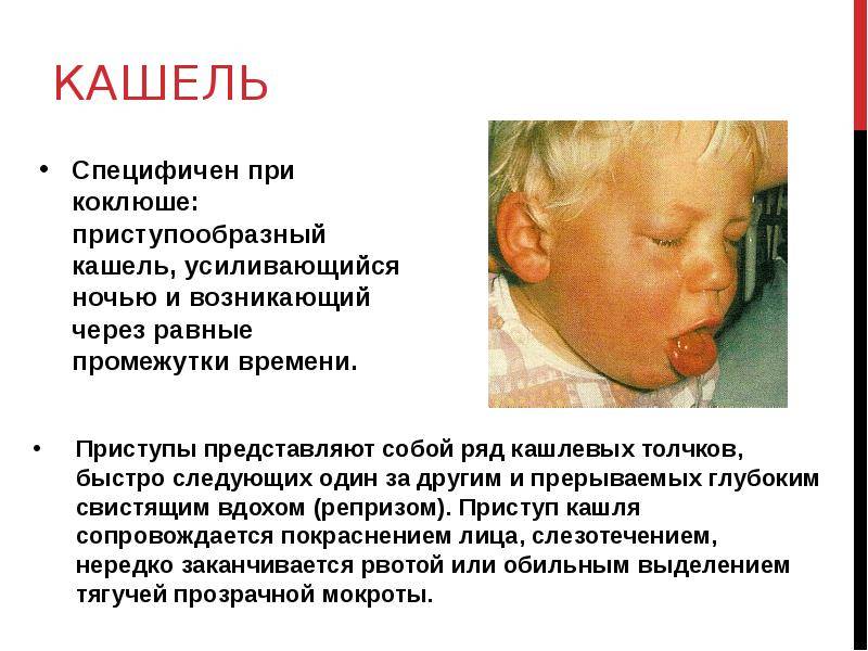 Кашель у грудного ребенка без температуры и насморка (причины и как лечить)