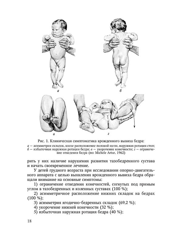 Рентген (рентгенография) тазобедренного сустава у детей