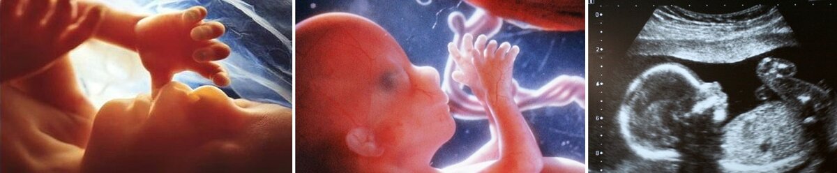 Психология младенца, или четвертый триместр беременности. как успокоить малыша. - страна мам