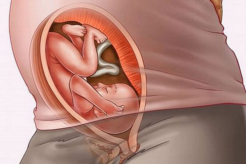Замершая беременность: симптомы, причины, комментарии врача