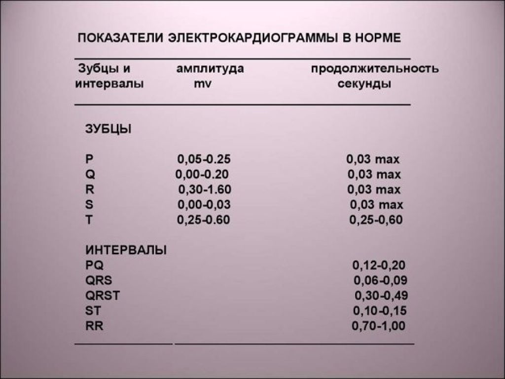 Р норм. Расшифровка показаний ЭКГ показатели нормы. Расшифровка результатов ЭКГ показатели нормы. Нормальные показатели зубцов на ЭКГ. Нормы интервалов на ЭКГ У взрослых.