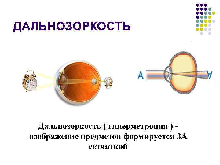 Почему в глазу дальнозоркого человека изображение близких предметов размытое